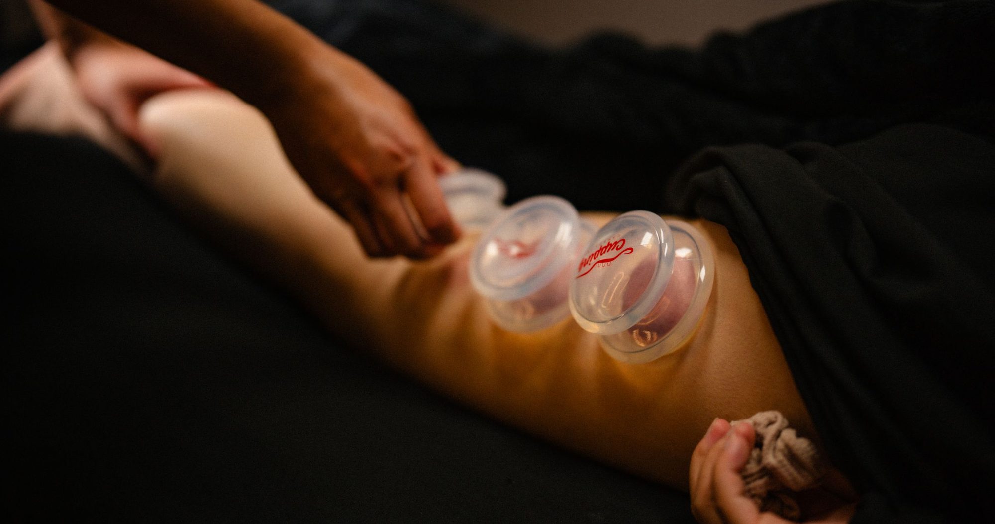 Cupping therapy on a client in a dimly lit treatment room